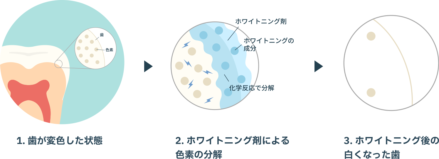 歯が白くなるメカニズム